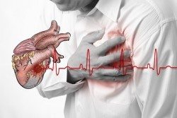 Marijuana Heart Attack Risk